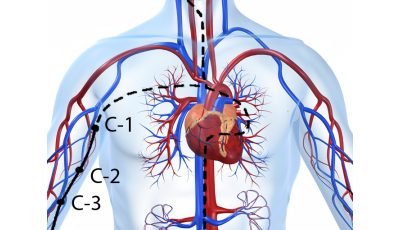 Канал Сердца, диагностика и методы воздействия